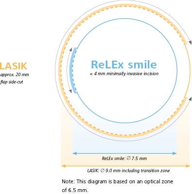 Relex Smile Image Of Relex Smile